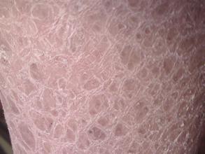 鱼病和鱼鳞病有哪些具体症状表现？