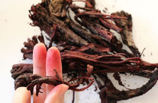 屁股花了怎么治疗？中医外敷加内调效果佳