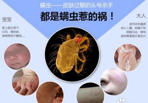 螨虫的抗药性