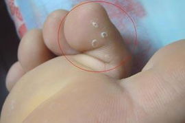 何氏凤仙患白粉病，如何是好？