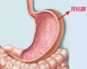 腺肌胃炎解析：症状、成因及防控要点