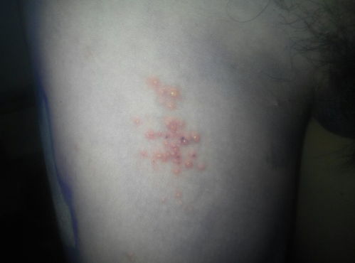 嘧菌环胺药害严重怎么办？紧急攻略来啦！