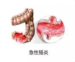 增生性肠炎与非瘟如何区分？