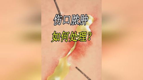 伤口染上农药后的麻烦事