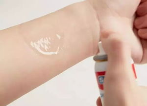 喷喷喷，伤口会飞快愈合吗？