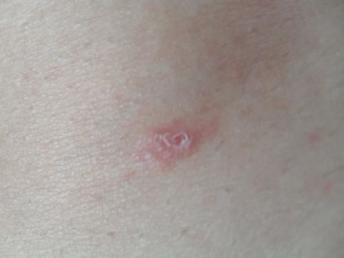 一、改善皮肤健康