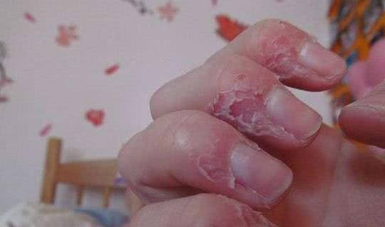 2. 中毒危机， 身体不适可大可小