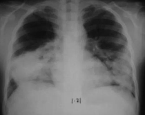 其他农药也凶险