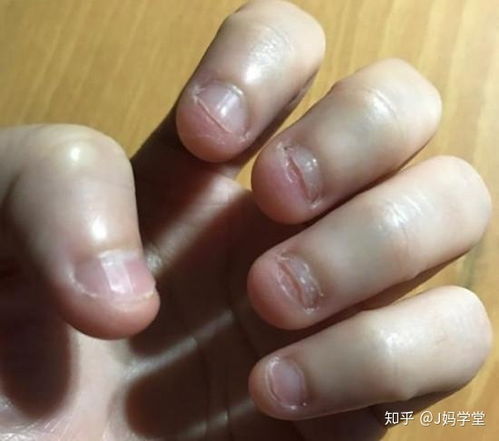 杀虫剂，喷还是不喷？这是个问题