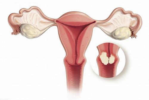 母牛卵巢静止现象：症状、原因与治疗指南