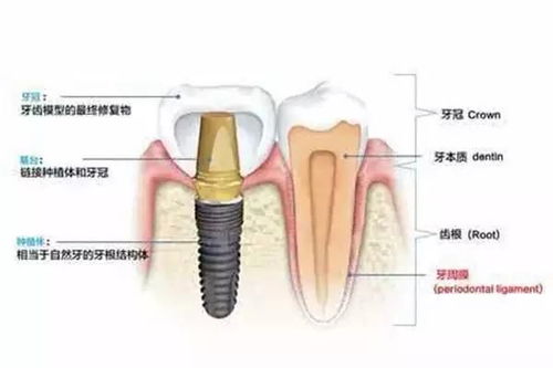 树根如何快速有效地被除掉？