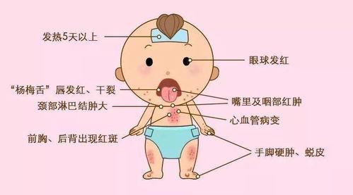 过敏反应的处理