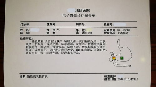 北方暖气房注意事项：