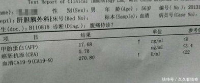 甲胎蛋白：那个不常见的名字， 背后隐藏的健康风险