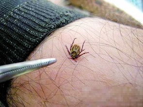 蜱虫用什么农药Ke以杀死？