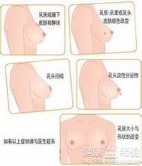 肝肾康用于治疗肝肾阴虚、肝气郁结所致的头晕、目眩、胁痛、腰膝酸软等症