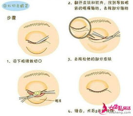 第一步：检查和诊断