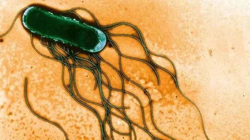 蜘蛛发病多因环境恶化、食物中毒、疾病感染等引起