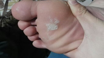 四、治疗方法大揭秘，我要试试堪！