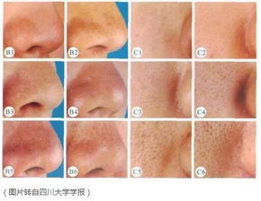 用盐洗脸可深层清洁毛孔，去除老化角质