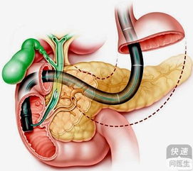姬玉露烂根后如何通过自然方法进行有效治疗和恢复
