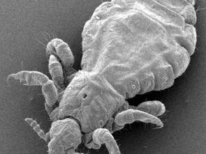 农药洗头的往事回忆