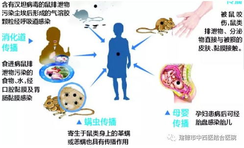 第二步：准备好移植用的工具和材料