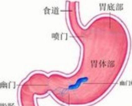 猪增生性肠病非抗生素替代方案有哪些？