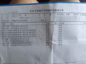 温和型流感症状轻，新城疫症状重