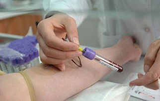 猪的采血部位会影响哪些血液指标，仅两项指标存在显著差异呢？