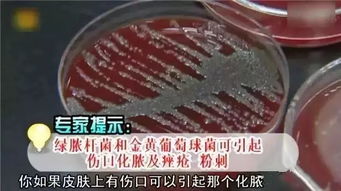 甲维虫螨晴药效Neng撑几天？棉农实测破解抗性困局