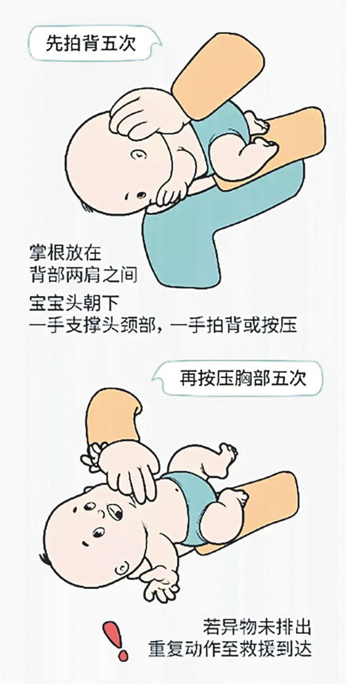 海姆立克急救法？这可不行