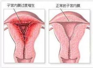 牛流产，疑似布病