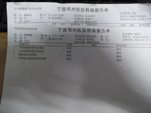 温和型流感症状轻，新城疫症状重