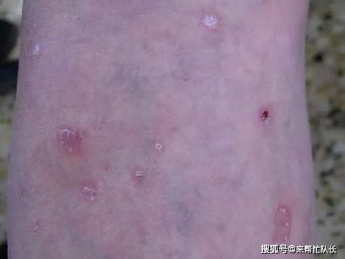 牡丹红斑病，你知道吗？