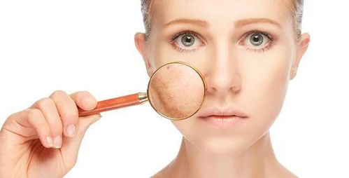 去垢剂对皮肤的影响