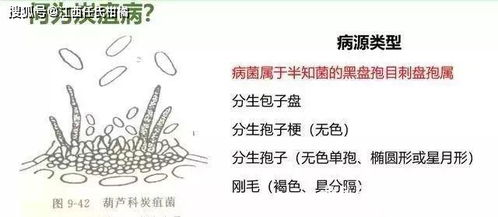 炭疽病简介：它来了你得防