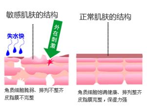 1. 皮肤敏感的人要小心