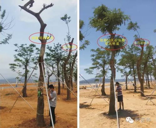 土球包扎物未解除