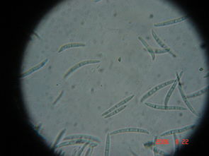 镜检病原孢子， 有点像小棍棍