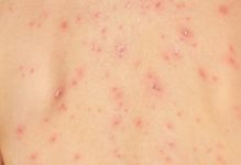 乙草胺：一种令人担忧的除草剂