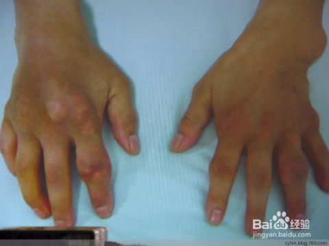 软筋藤的多样用法