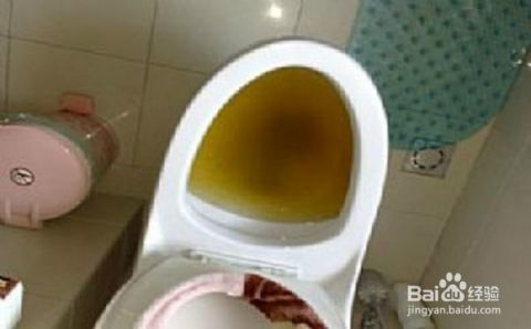 茶叶包不慎倒入马桶堵塞，如何迅速解决？