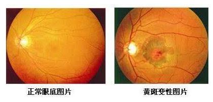 真柏黄斑之谜：是红蜘蛛病吗？