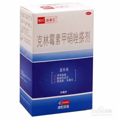 甲硝唑凝胶的正确用法