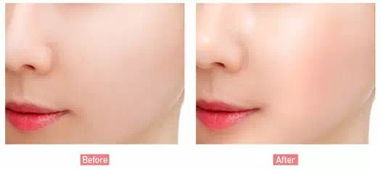 农药喷在脸上，是不是正常的反应？