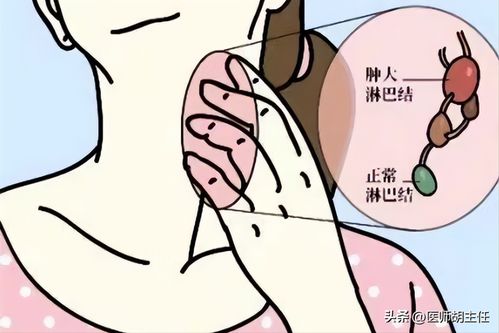 水肿病还是伪狂犬？皮肤肿胀是哪一种病的征兆