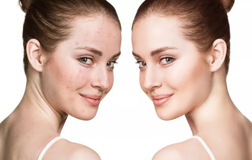 红车轴草：肌肤焕发光彩，天然美肤神器