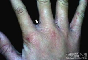 平安使用杀虫剂