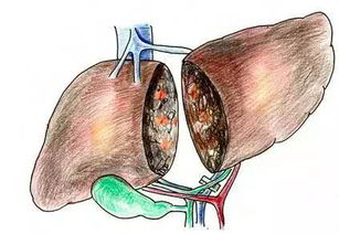 肝脏“中枪”，谁之过？